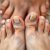 Choroby paznokci u nóg: grzybica i skuteczne metody leczenia